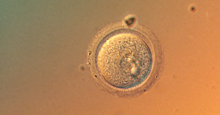 base editing human embryos