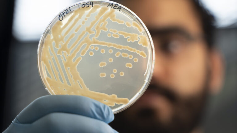 Ötzi the Iceman microbes